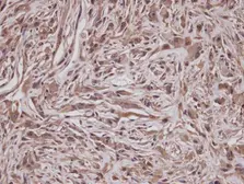 Anti-GRAP antibody [C2C3], C-term used in IHC (Paraffin sections) (IHC-P). GTX104623
