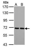 Anti-PCK2 antibody [C1C2], Internal used in Western Blot (WB). GTX104663