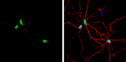 Anti-CPEB1 antibody [C3], C-term used in Immunocytochemistry/ Immunofluorescence (ICC/IF). GTX104682