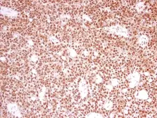 Anti-PRPF39 antibody [N2C1], Internal used in IHC (Paraffin sections) (IHC-P). GTX104949