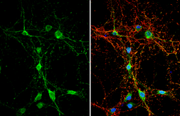 Anti-DAG1 antibody used in Immunocytochemistry/ Immunofluorescence (ICC/IF). GTX105038