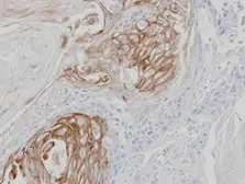 Anti-ZPBP antibody used in IHC (Paraffin sections) (IHC-P). GTX105073