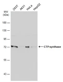 Anti-CTP synthase antibody [N1C1] used in Western Blot (WB). GTX105265