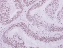 Anti-ULK4 antibody [N2C1], Internal used in IHC (Paraffin sections) (IHC-P). GTX105365