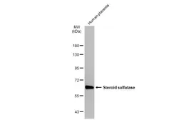 Anti-Steroid sulfatase antibody [N1C3] used in Western Blot (WB). GTX105498