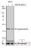 Anti-Cytokeratin 18 antibody [N2C2], Internal used in Western Blot (WB). GTX105624