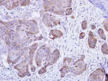Anti-Calsequestrin 2 antibody used in IHC (Paraffin sections) (IHC-P). GTX105914
