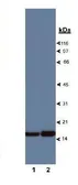 Anti-Profilin 1 antibody used in Western Blot (WB). GTX10608
