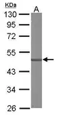 Anti-SDCCAG3 antibody [C1C3] used in Western Blot (WB). GTX106180