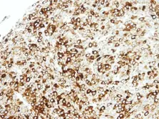 Anti-STAP2 antibody [C3], C-term used in IHC (Paraffin sections) (IHC-P). GTX106287