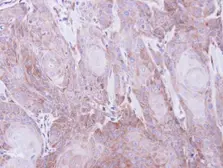 Anti-SEC61A1 antibody used in IHC (Paraffin sections) (IHC-P). GTX106455
