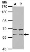 Anti-RAP1GDS1 antibody [N1N2], N-term used in Western Blot (WB). GTX106506