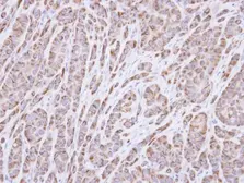 Anti-p40 antibody [N3C3] used in IHC (Paraffin sections) (IHC-P). GTX106557