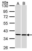 Anti-FAM50A antibody [N3C3] used in Western Blot (WB). GTX106590