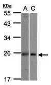 Anti-MID1IP1 antibody used in Western Blot (WB). GTX106864