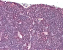 Anti-Lck antibody [N1C1] used in IHC (Paraffin sections) (IHC-P). GTX107432