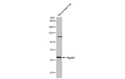 Anti-Dyrk3 antibody used in Western Blot (WB). GTX107889