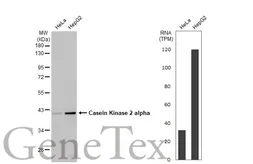 Anti-Casein Kinase 2 alpha antibody used in Western Blot (WB). GTX107897
