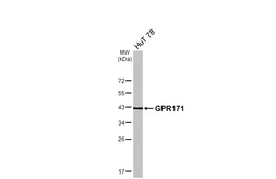 Anti-GPR171 antibody [N1], N-term used in Western Blot (WB). GTX108131
