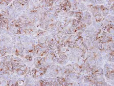 Anti-GALR3 antibody used in IHC (Paraffin sections) (IHC-P). GTX108163