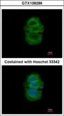 Anti-alpha TTP antibody [C2C3], C-term used in Immunocytochemistry/ Immunofluorescence (ICC/IF). GTX108286