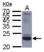 Anti-Hepatitis B virus 2a small S Protein antibody used in Western Blot (WB). GTX108380