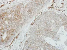 Anti-HLA-DMB antibody [C2C3], C-term used in IHC (Paraffin sections) (IHC-P). GTX108492