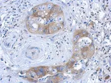 Anti-IL1 Receptor 1 antibody [C3], C-term used in IHC (Paraffin sections) (IHC-P). GTX108494
