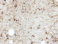 Anti-IL2 Receptor beta antibody [C3], C-term used in IHC (Paraffin sections) (IHC-P). GTX108495