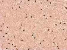 Anti-P2X2 antibody [C3], C-term used in IHC (Paraffin sections) (IHC-P). GTX108534