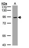 Anti-LRP12 antibody [C3], C-term used in Western Blot (WB). GTX108542