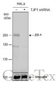 Anti-ZO-1 antibody used in Western Blot (WB). GTX108592