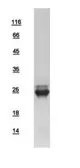 Human N-Ras protein, His tag. GTX108598-pro