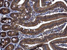 Anti-ARL14 antibody [N1C3] used in IHC (Paraffin sections) (IHC-P). GTX108599