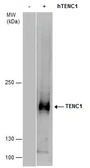 Anti-TENC1 antibody [C2C3], C-term used in Western Blot (WB). GTX108618