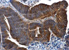 Anti-IL1 Receptor 2 antibody [N3C3] used in IHC (Paraffin sections) (IHC-P). GTX108702