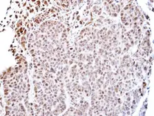 Anti-TEAD4 antibody used in IHC (Paraffin sections) (IHC-P). GTX108750