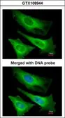 Anti-TNNI3K antibody [N2C1], Internal used in Immunocytochemistry/ Immunofluorescence (ICC/IF). GTX108944