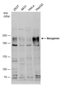 Anti-Neogenin antibody [N1N2], N-term used in Western Blot (WB). GTX109043