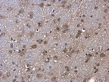 Anti-ID2 antibody [N1C3] used in IHC (Paraffin sections) (IHC-P). GTX109113