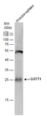 Anti-GSTT1 antibody used in Western Blot (WB). GTX109250