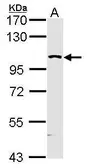 Anti-KHS antibody [N3C1], Internal used in Western Blot (WB). GTX109297