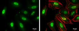 Anti-TKTL1 antibody [N1C1] used in Immunocytochemistry/ Immunofluorescence (ICC/IF). GTX109459