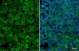 Anti-GCSF Receptor antibody [N2C1], Internal used in Immunocytochemistry/ Immunofluorescence (ICC/IF). GTX109503