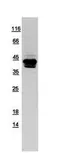 Human Syntaxin 18 protein, His tag. GTX109514-pro