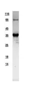 Human Syntaxin 11 protein, His tag. GTX109544-pro