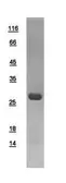 Human PGAM2 protein, His tag. GTX109582-pro