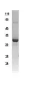 Human Ketohexokinase protein, His tag. GTX109591-pro