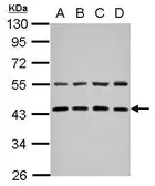 Anti-ZFYVE27 antibody [N3C3] used in Western Blot (WB). GTX109730