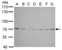 Anti-Lamin B2 antibody [N3C2], Internal used in Western Blot (WB). GTX109894